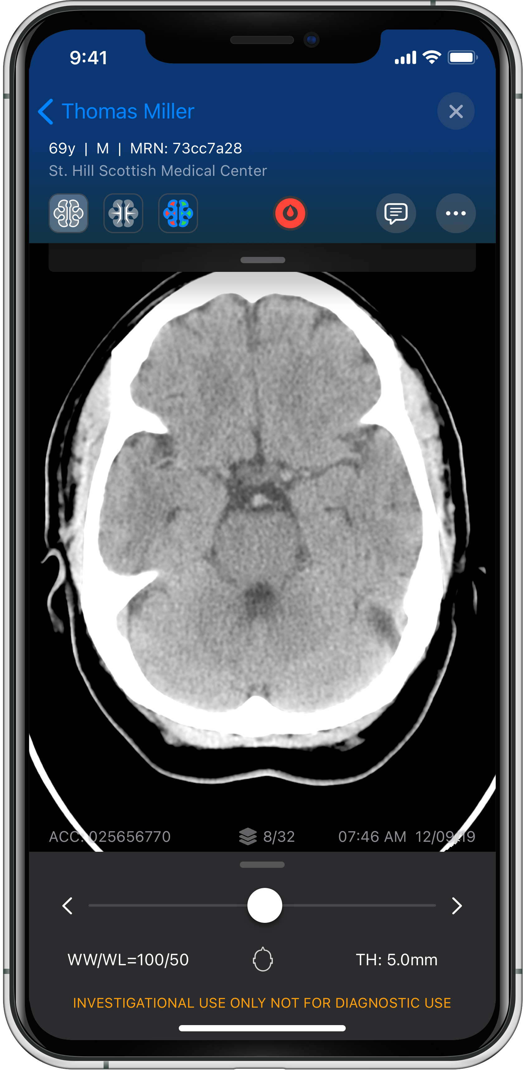 Viz app screen - radiologic viewer