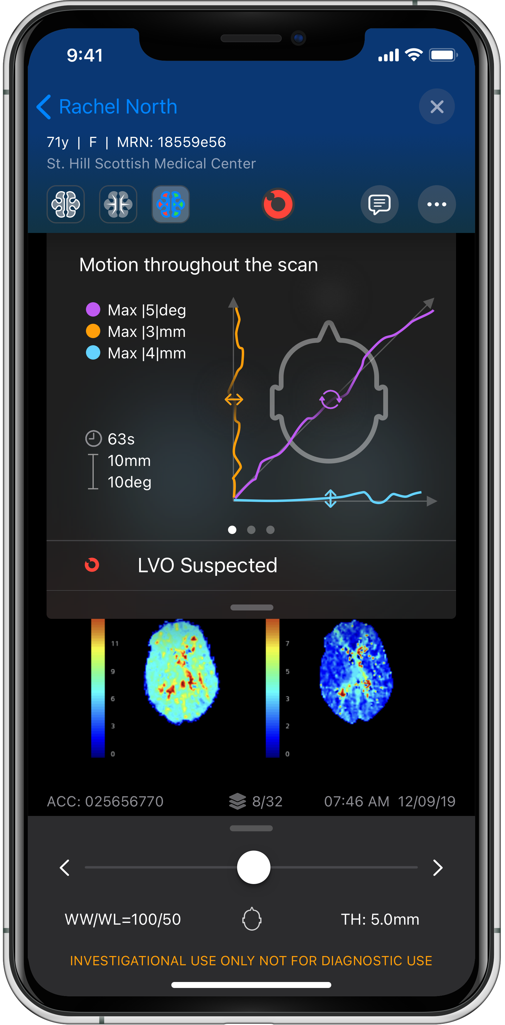 Viz app screen - alert workflow